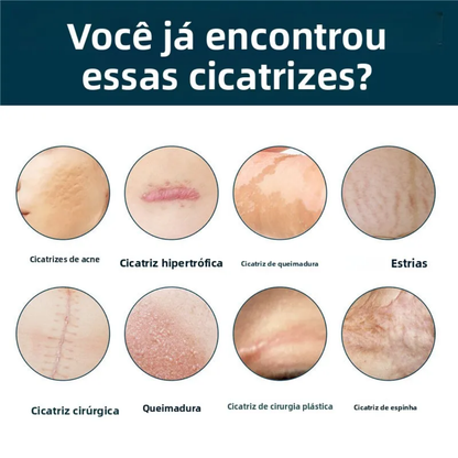 RevivaSkin™ - Gel avançado que apaga cicatrizes antigas e recentes