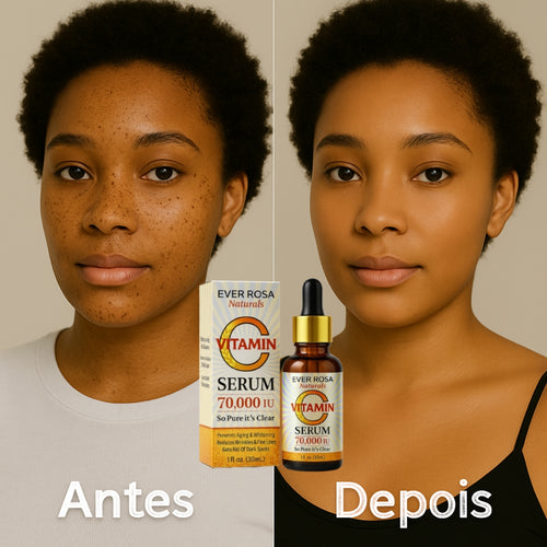 Sérum removedor de manchas