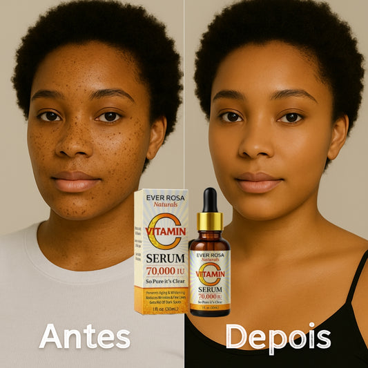 Sérum removedor de manchas