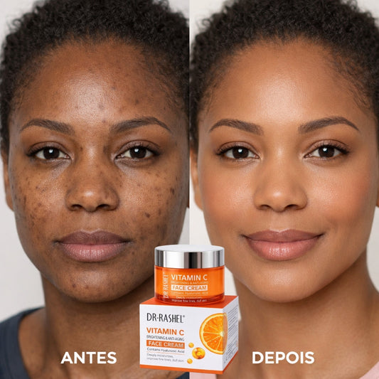 Creme removedor de manchas - Pele limpa em 14 dias 🔥